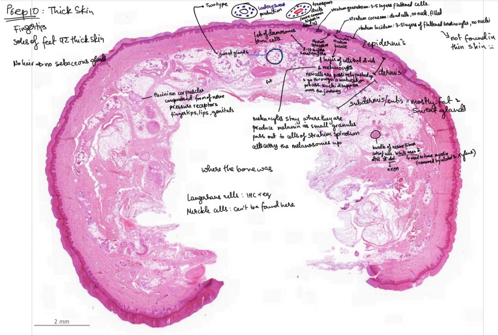 A tissue section with handwritten labels and annotations