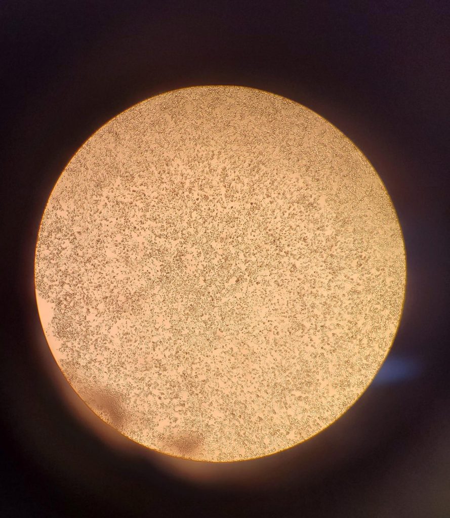 Studying the morphology of infected cells after 24 hours incubation with a certain virus; Credits: Vlad Popescu