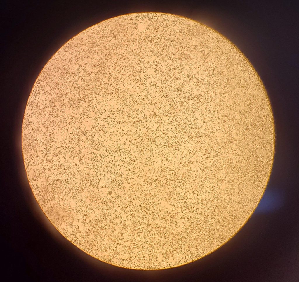 Studying the morphology of infected cells after 24 hours incubation with a certain virus; Credits: Vlad Popescu
