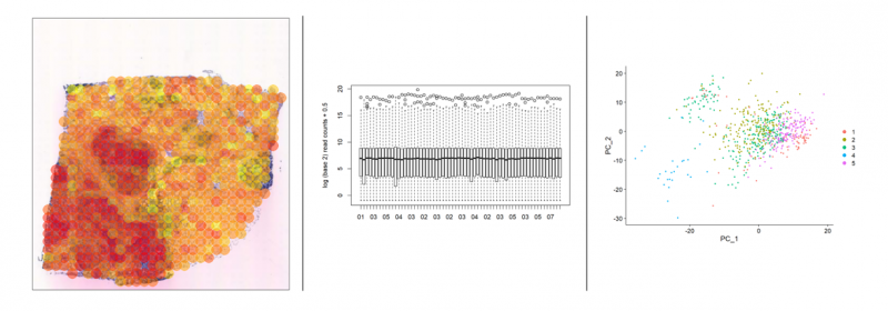 Data analysis result visuzlization for spatial transcriptomics, bulk RNA-Seq and scRNA-Seq. Credits: Inés Rivero García and Miren Urrutia Iturritza