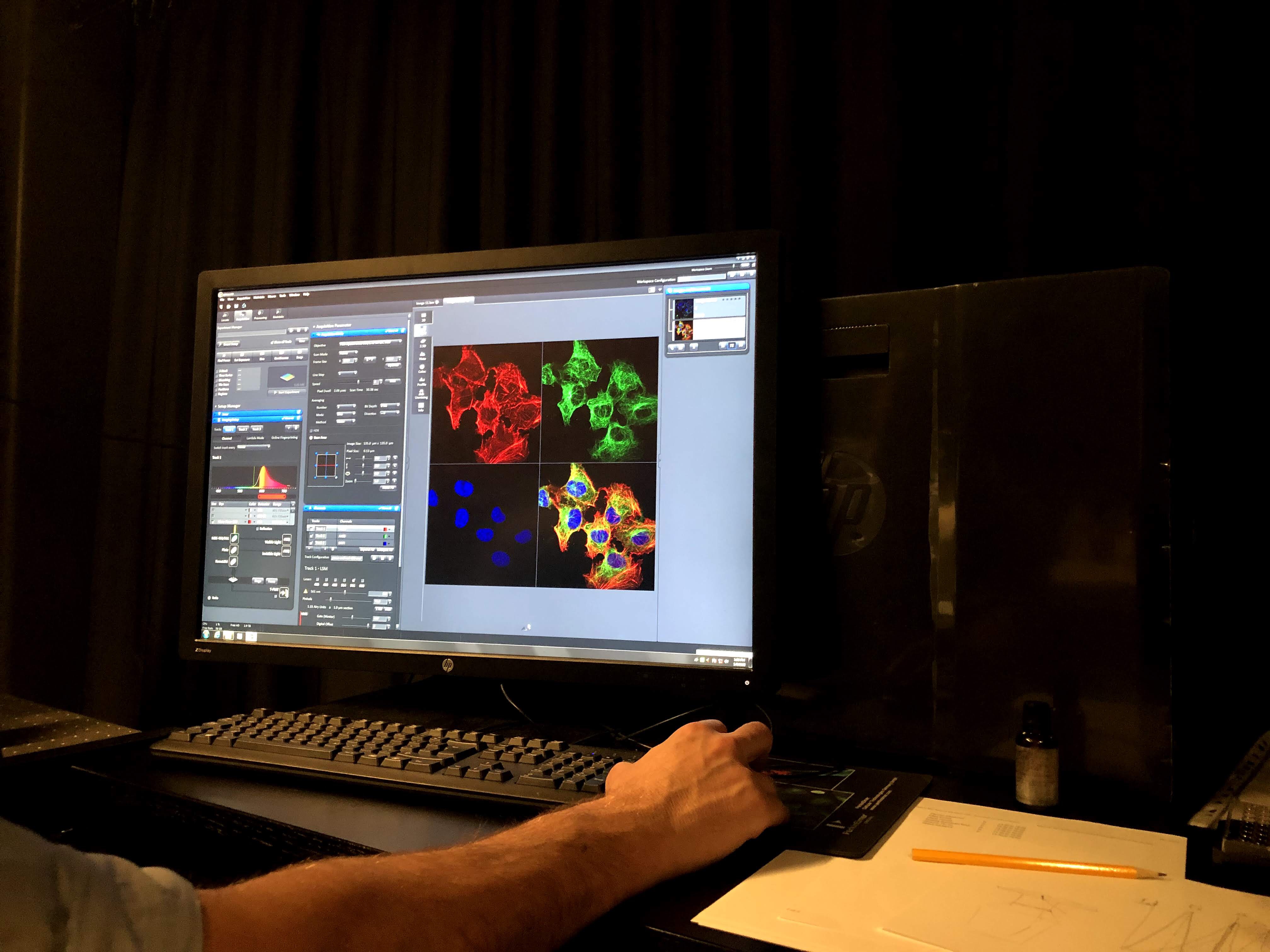 Four pictures of cells in an image manipulation software on a computer screen. Three pictures are red, blue, and green from fluorescent tags and the last image is an overlap of the first three. A person's hand holds the mouse,
