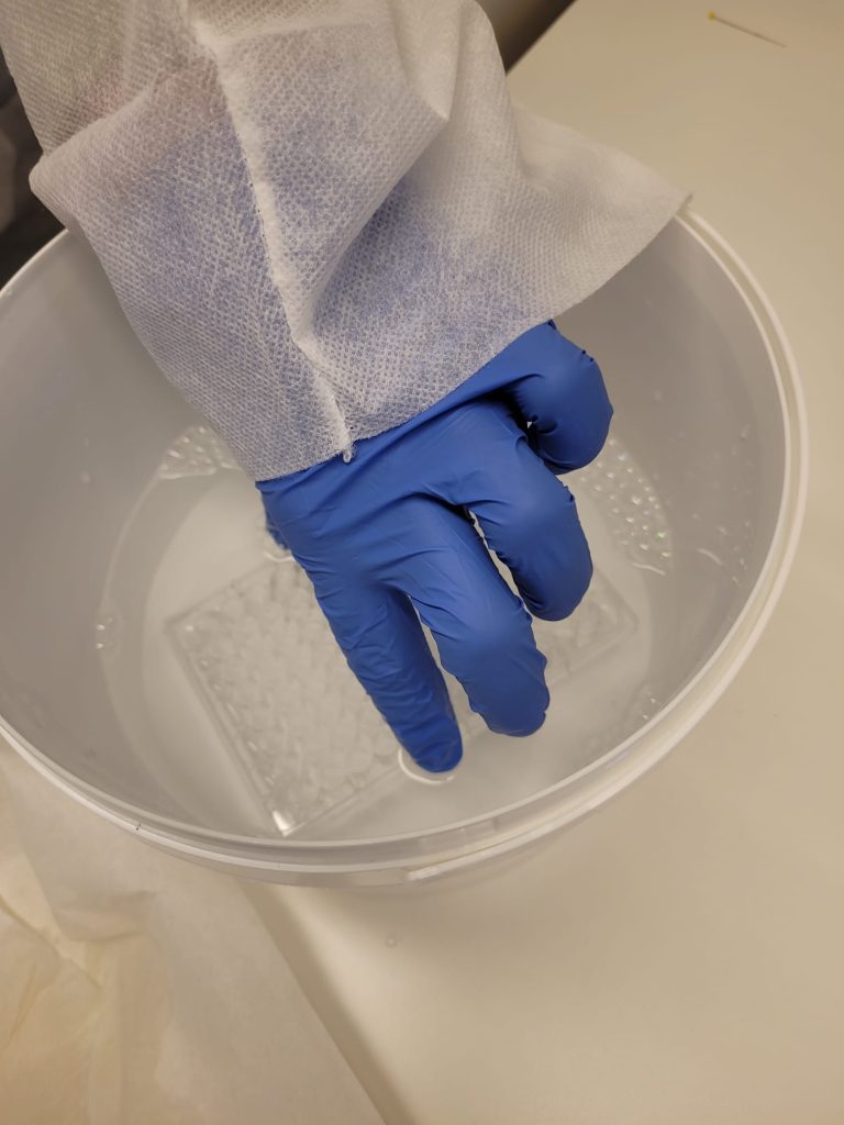Using wash buffer to remove capture antibody solution; Credits: Vlad Popescu
